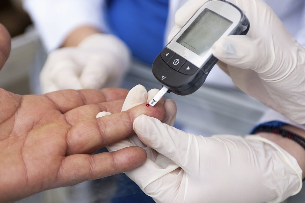 Blood test to determine fasting plasma glucose concentration to diagnose diabetes